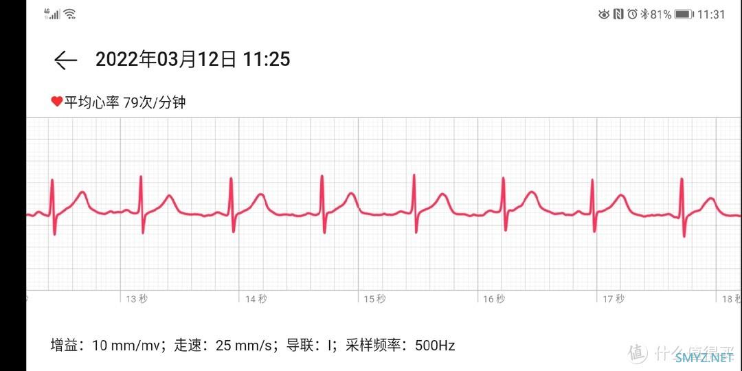 绝对值买的华为watch  gt2 pro ecg 看看值在哪里