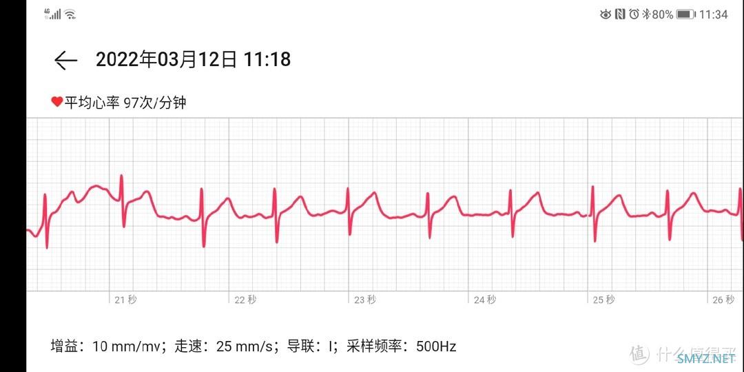 绝对值买的华为watch  gt2 pro ecg 看看值在哪里