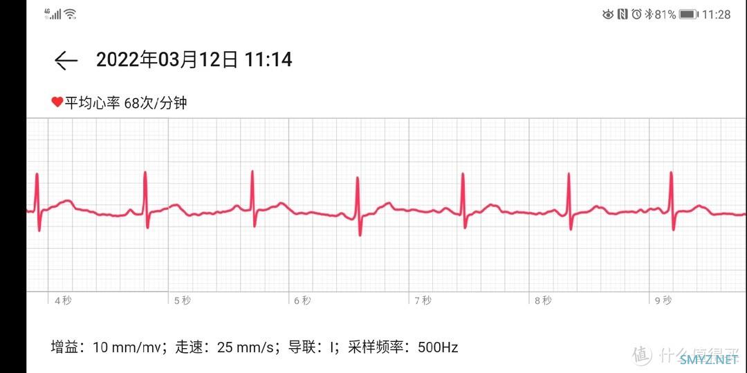 绝对值买的华为watch  gt2 pro ecg 看看值在哪里