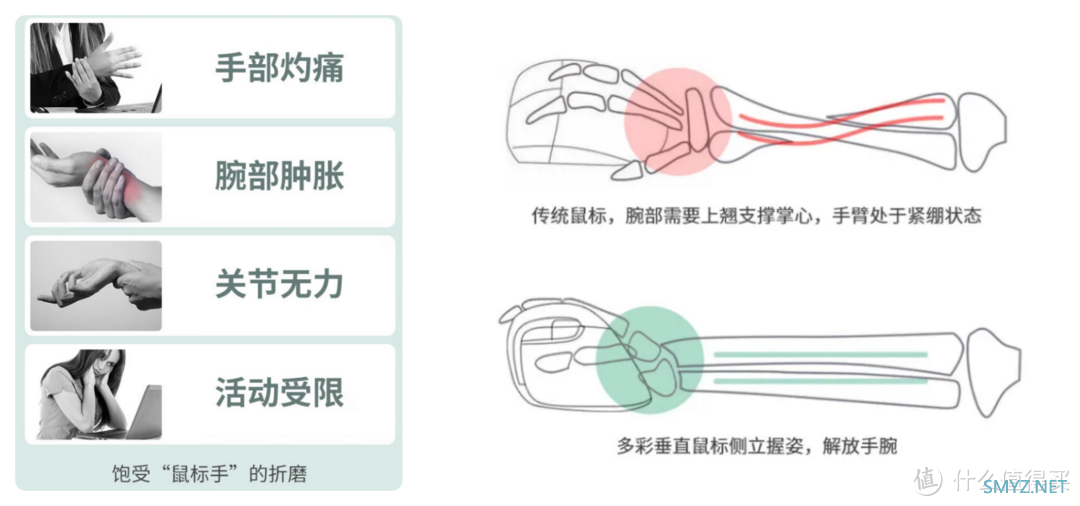 拯救“鼠标手”，多彩人体工学鼠标定义新握姿